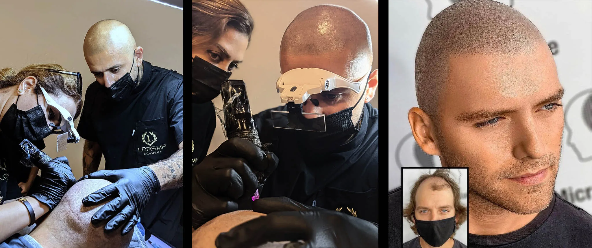 LDRSMP Academy Scalp Micropigmentation